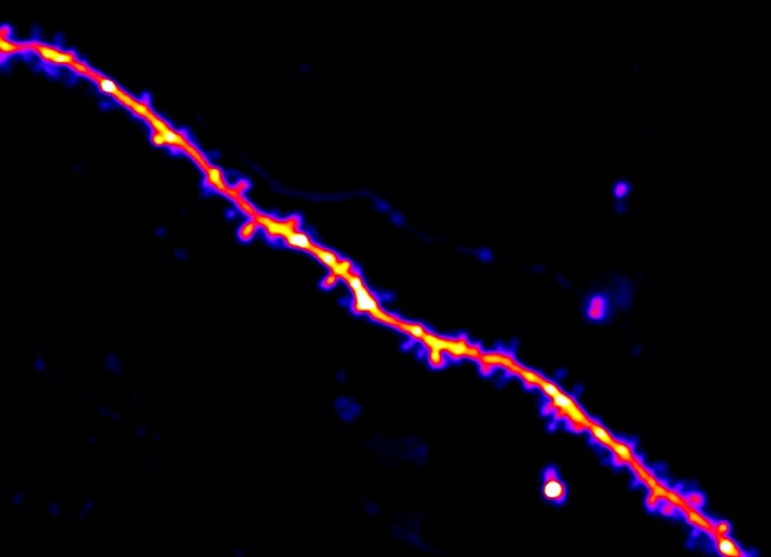 Synaptic connections on dendrites of mouse neurons
